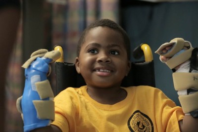 Zion Harvey, chlapec s oboustranně transplantovanýma rukama. Příkald, kdy se operace povedla. Foto: The Children´s Hospital of Philadelphia